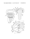 PROSTHETIC IMPLANT AND ASSEMBLY METHOD diagram and image