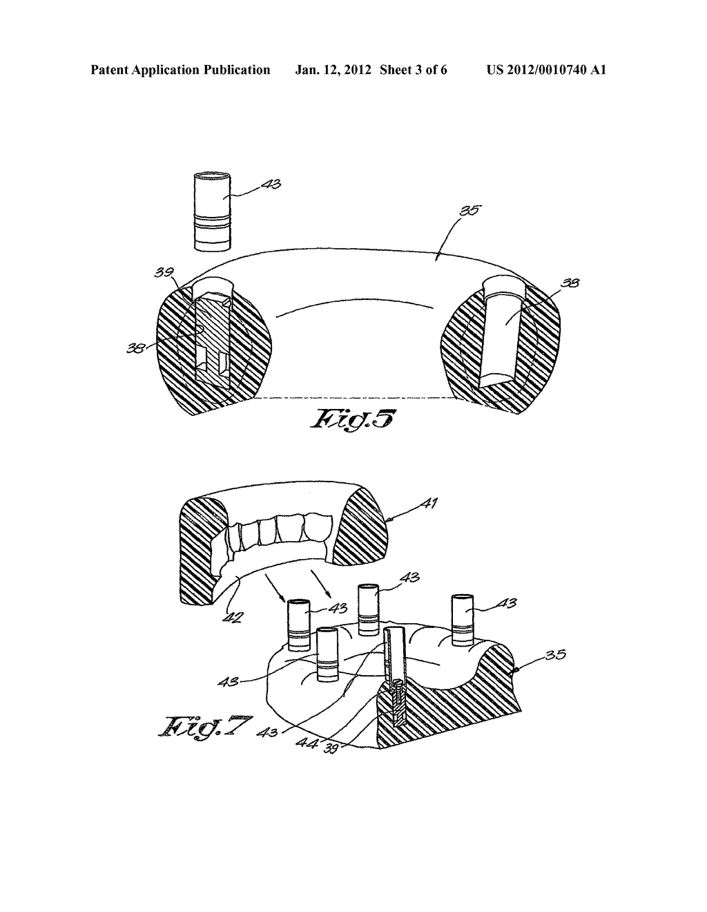 METHOD FOR PLACING AND MANUFACTURING A DENTAL SUPERSTRUCTURE, METHOD FOR     PLACING IMPLANTS AND ACCESSORIES USED THEREBY - diagram, schematic, and image 04
