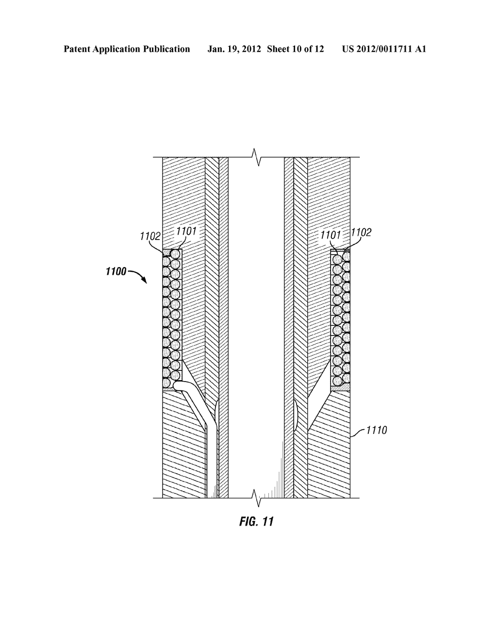 STIMULATION LEAD, STIMULATION SYSTEM, AND METHOD FOR LIMITING MRI INDUCED     CURRENT IN A STIMULATION LEAD - diagram, schematic, and image 11