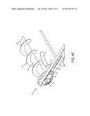 Variable Speed Lean Bar diagram and image