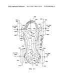 Wearable Device diagram and image