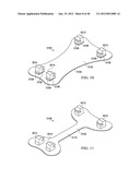 Wearable Device diagram and image