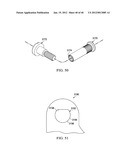 Wearable Device diagram and image