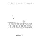 SYSTEMS AND METHODS FOR INSPECTION OF STENTS diagram and image