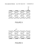 SYSTEMS AND METHODS FOR INSPECTION OF STENTS diagram and image
