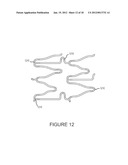 SYSTEMS AND METHODS FOR INSPECTION OF STENTS diagram and image