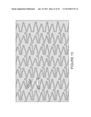 SYSTEMS AND METHODS FOR INSPECTION OF STENTS diagram and image