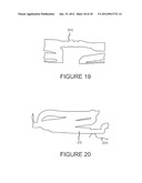 SYSTEMS AND METHODS FOR INSPECTION OF STENTS diagram and image