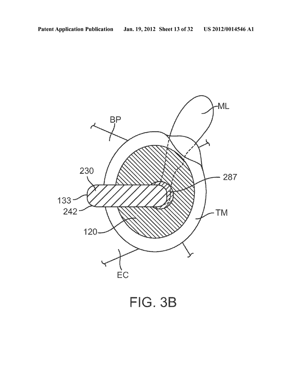 BALANCED ARMATURE DEVICES AND METHODS FOR HEARING - diagram, schematic, and image 14