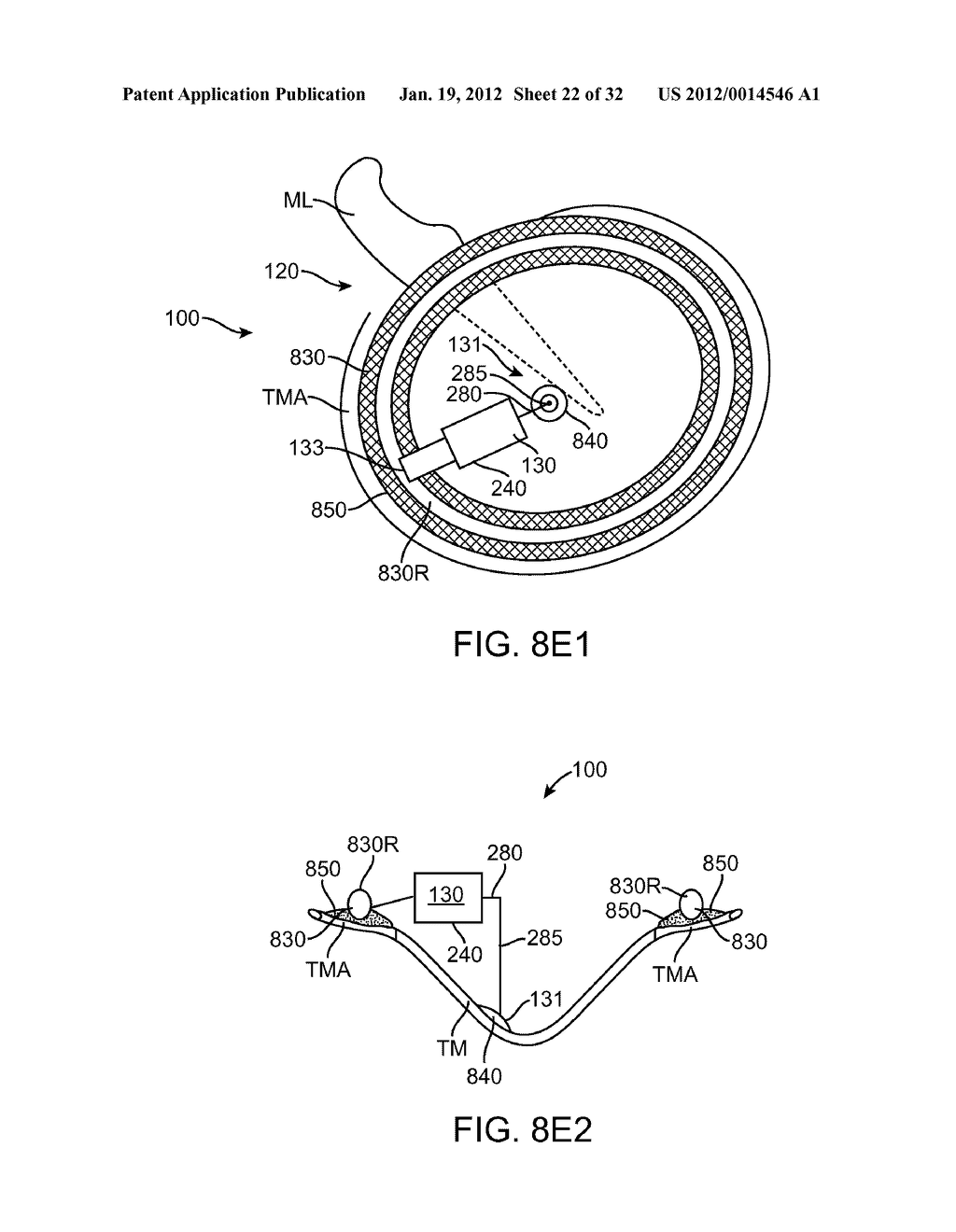 BALANCED ARMATURE DEVICES AND METHODS FOR HEARING - diagram, schematic, and image 23