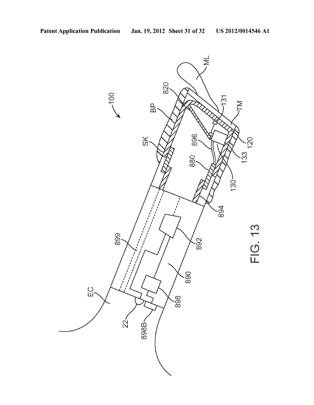 BALANCED ARMATURE DEVICES AND METHODS FOR HEARING - diagram, schematic, and image 32