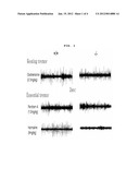 METHOD FOR THE PREVENTION AND TREATMENT OF ESSENTIAL TREMOR BY REGULATING     alpha1G T-TYPE CALCIUM CHANNEL OR BY T-TYPE CALCIUM CHANNEL BLOCKERS diagram and image