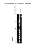 GENETIC PRODUCTS DIFFERENTIALLY EXPRESSED IN TUMORS AND USE THEREOF diagram and image