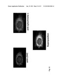 GENETIC PRODUCTS DIFFERENTIALLY EXPRESSED IN TUMORS AND USE THEREOF diagram and image