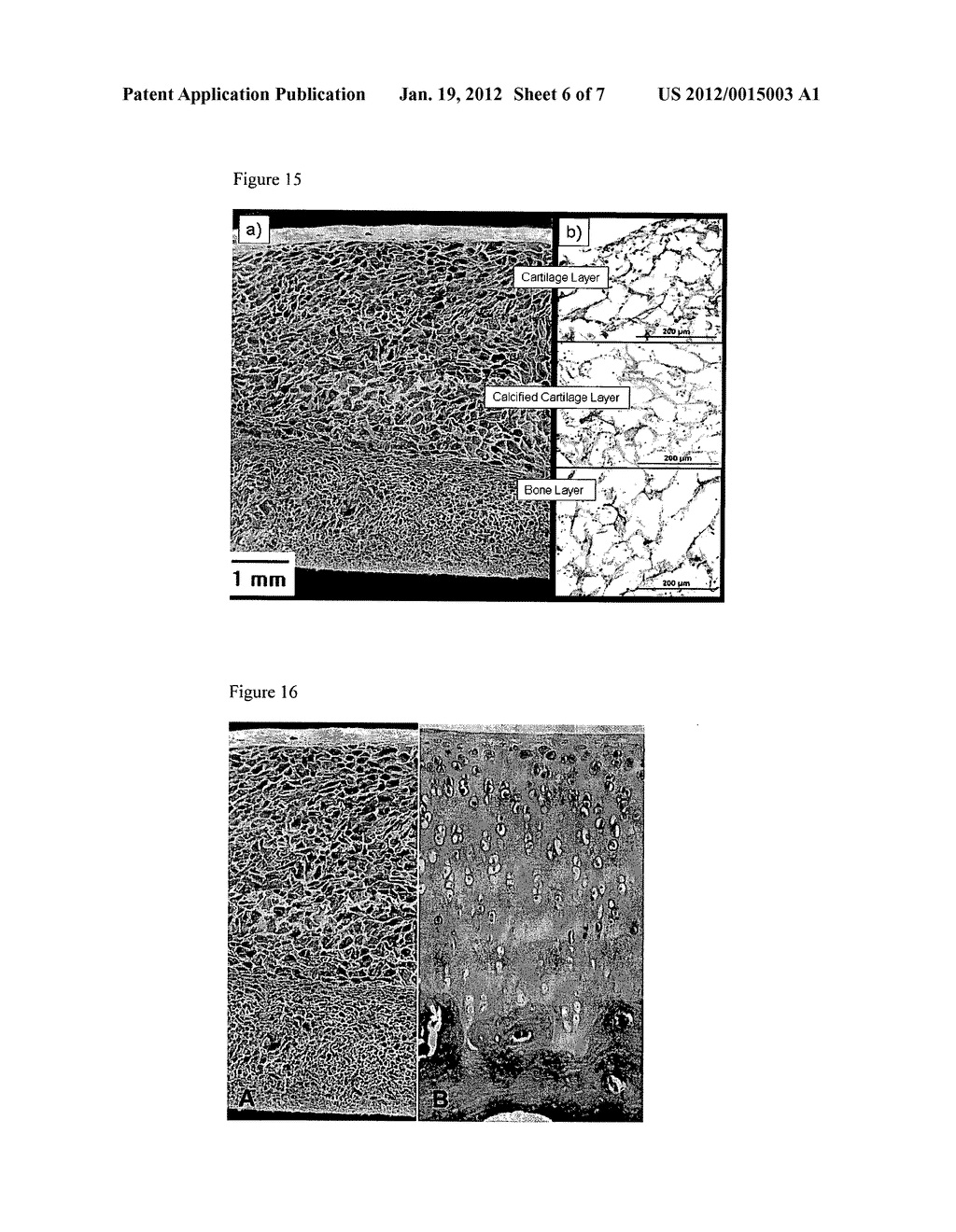 Layered Scaffold Suitable for Osteochondral Repair - diagram, schematic, and image 07