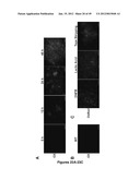 Dendritic Cell Precursor Populations, Dendritic Cell Populations Derived     Therefrom and Uses Thereof diagram and image