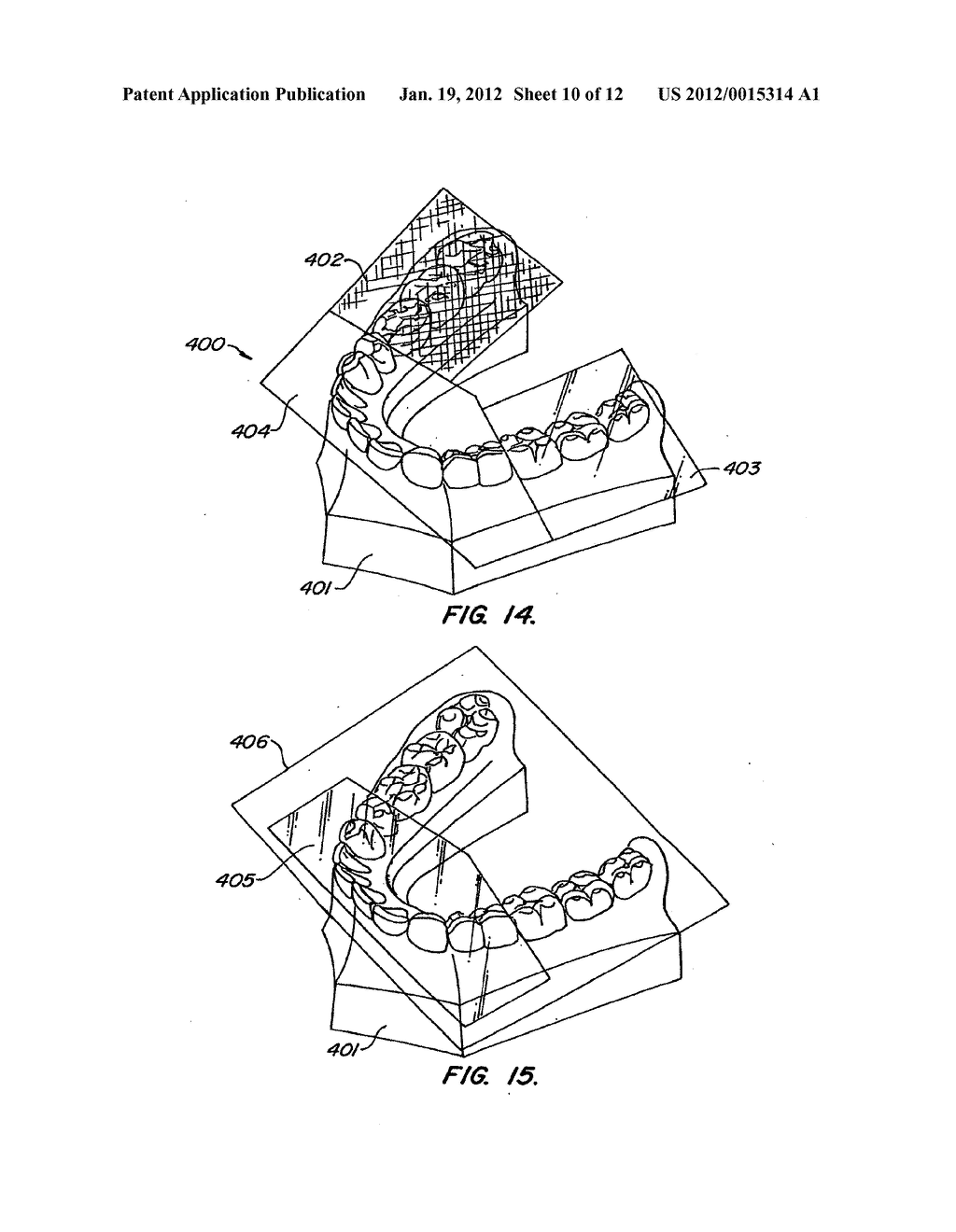 SYSTEMS AND METHODS FOR VARYING ELASTIC MODULUS APPLIANCES - diagram, schematic, and image 11