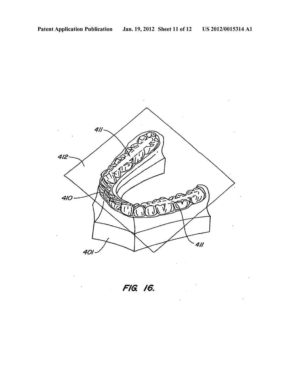 SYSTEMS AND METHODS FOR VARYING ELASTIC MODULUS APPLIANCES - diagram, schematic, and image 12