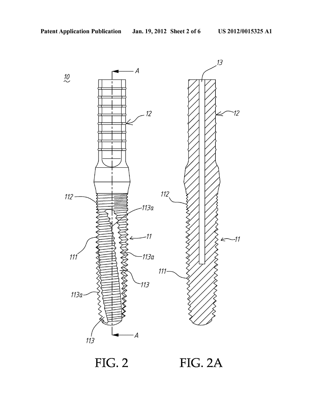 RESTORABLE ONE PIECE IMPLANT - diagram, schematic, and image 03