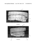 METHOD OF DESIGNING A DENTAL PROSTHETIC, AND COMPUTER READABLE MEDIUM FOR     PERFORMING A METHOD OF DESIGNING A DENTAL PROSTHETIC diagram and image