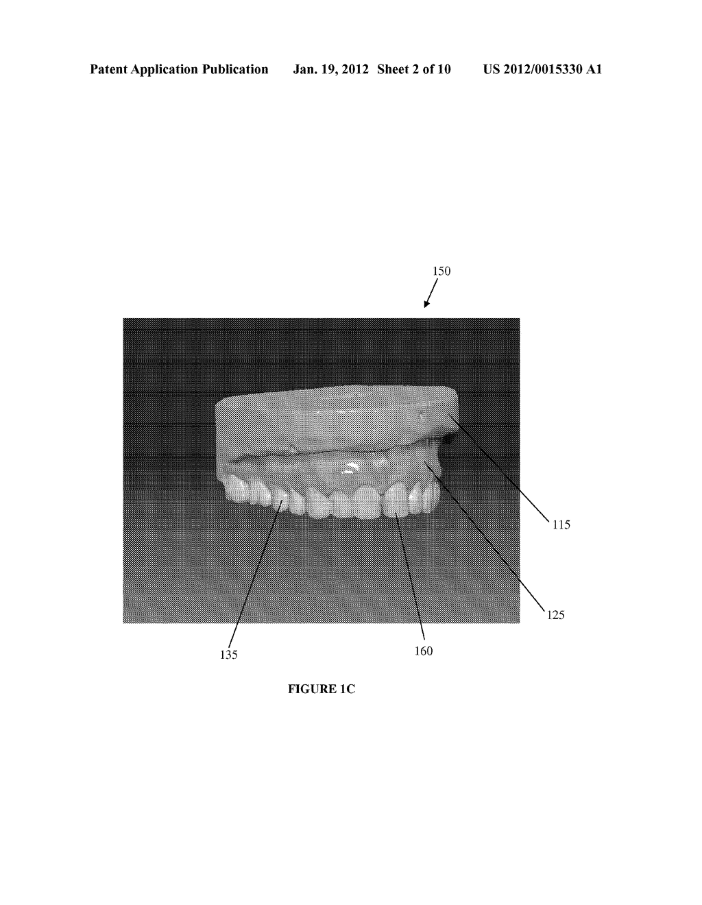 METHOD OF DESIGNING A DENTAL PROSTHETIC, AND COMPUTER READABLE MEDIUM FOR     PERFORMING A METHOD OF DESIGNING A DENTAL PROSTHETIC - diagram, schematic, and image 03