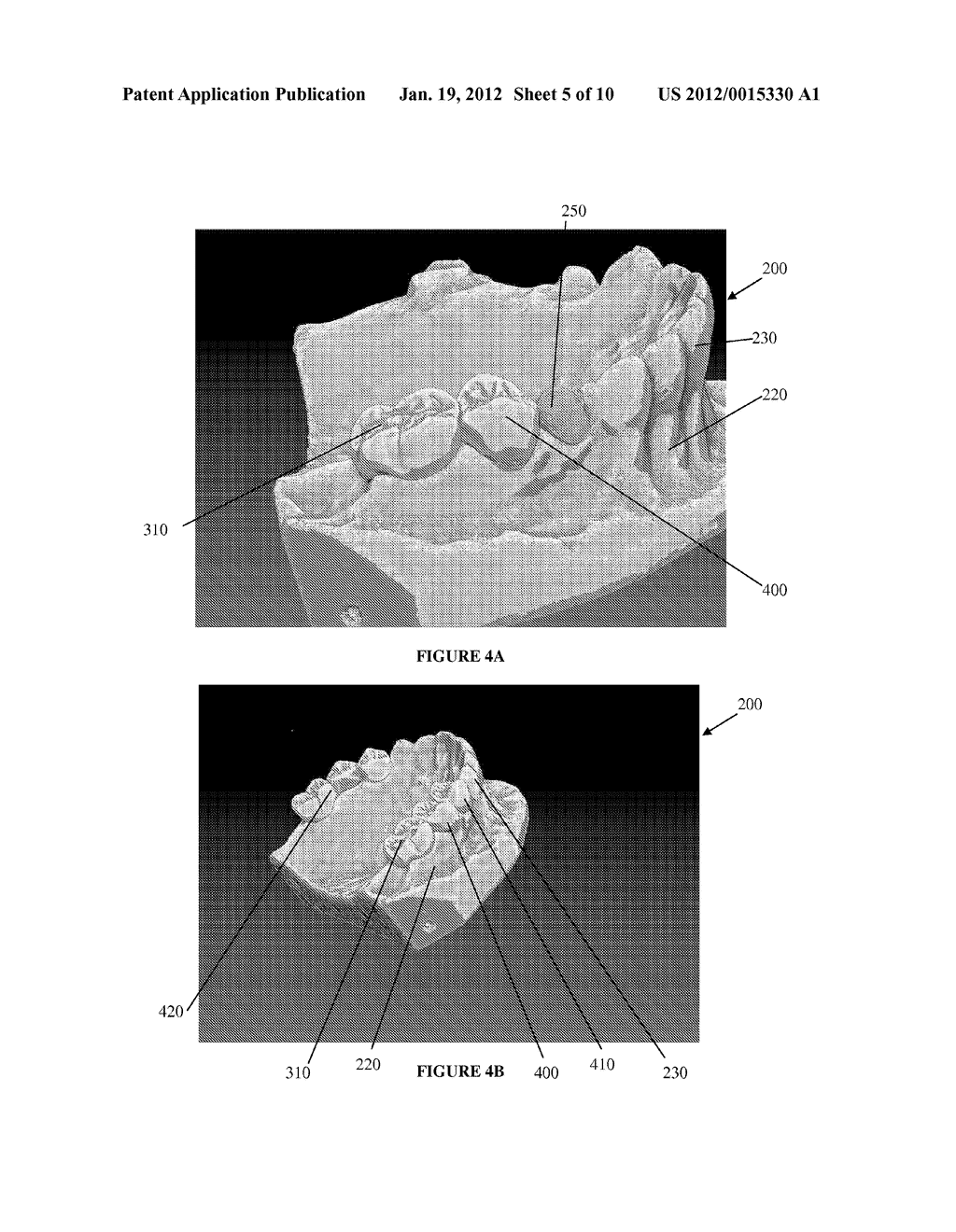 METHOD OF DESIGNING A DENTAL PROSTHETIC, AND COMPUTER READABLE MEDIUM FOR     PERFORMING A METHOD OF DESIGNING A DENTAL PROSTHETIC - diagram, schematic, and image 06