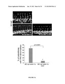 METHOD FOR THE SELECTION OF ENDOTHELIAL CELLS DEATH INDUCERS VIA NETRIN-1     AND ITS APPLICATIONS diagram and image