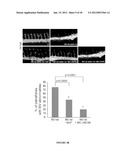 METHOD FOR THE SELECTION OF ENDOTHELIAL CELLS DEATH INDUCERS VIA NETRIN-1     AND ITS APPLICATIONS diagram and image