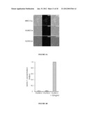 METHOD FOR THE SELECTION OF ENDOTHELIAL CELLS DEATH INDUCERS VIA NETRIN-1     AND ITS APPLICATIONS diagram and image