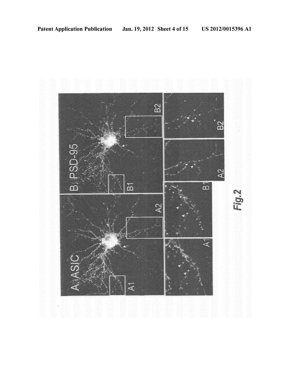 COMPOSITIONS AND METHODS FOR MODULATING THE ACID-SENSING ION CHANNEL     (ASIC) - diagram, schematic, and image 05