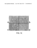 Method of Proliferating Plasma Cells diagram and image