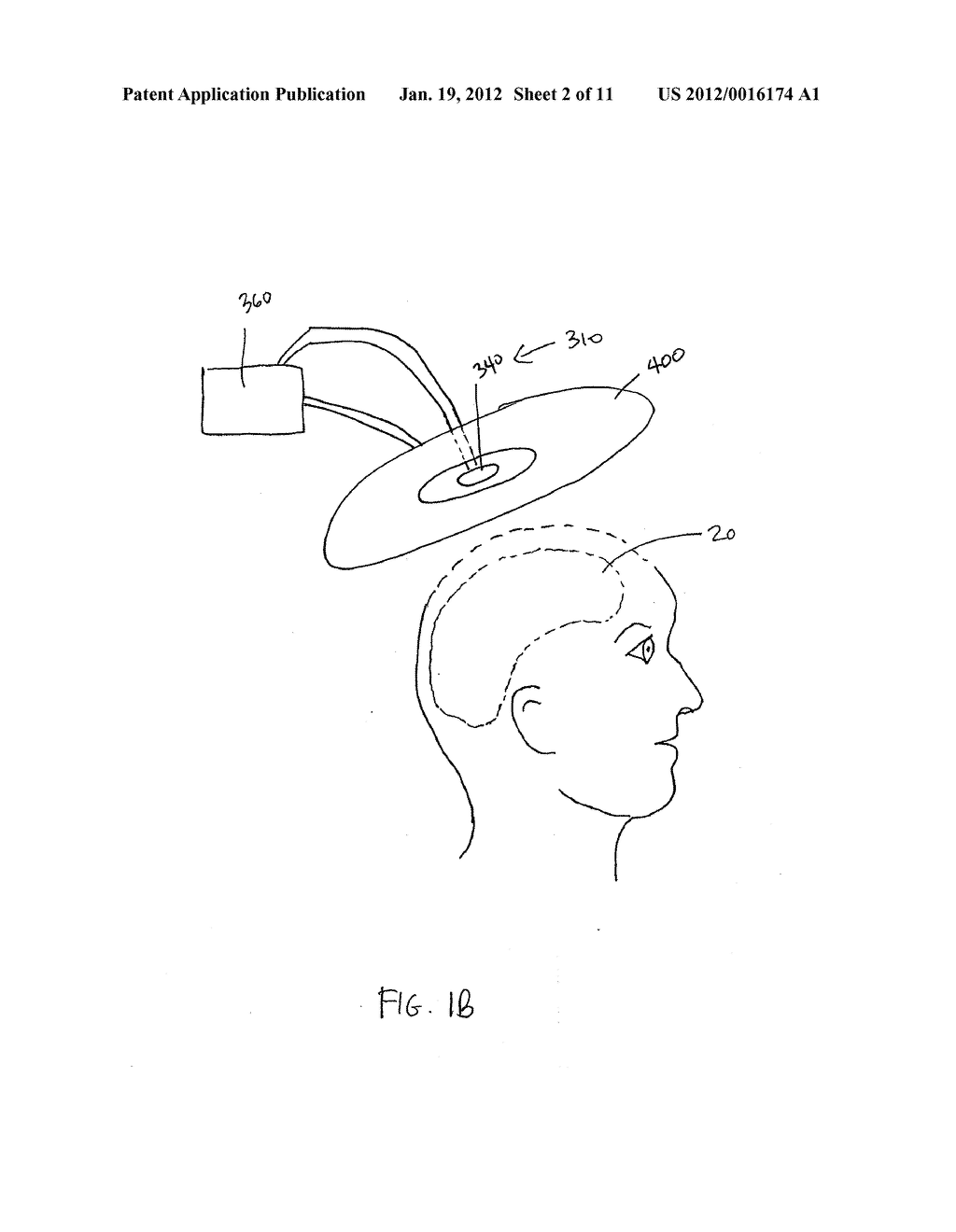 DEVICE AND METHOD FOR PROVIDING A SYNERGISTIC COMBINATION  OF PHOTOTHERAPY     AND A NON-LIGHT ENERGY MODALITY TO THE BRAIN - diagram, schematic, and image 03