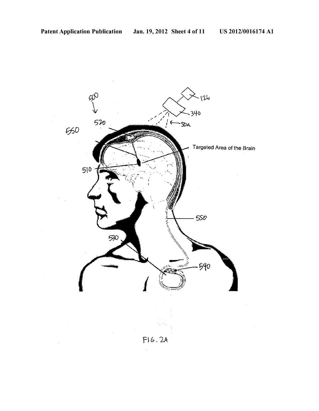 DEVICE AND METHOD FOR PROVIDING A SYNERGISTIC COMBINATION  OF PHOTOTHERAPY     AND A NON-LIGHT ENERGY MODALITY TO THE BRAIN - diagram, schematic, and image 05