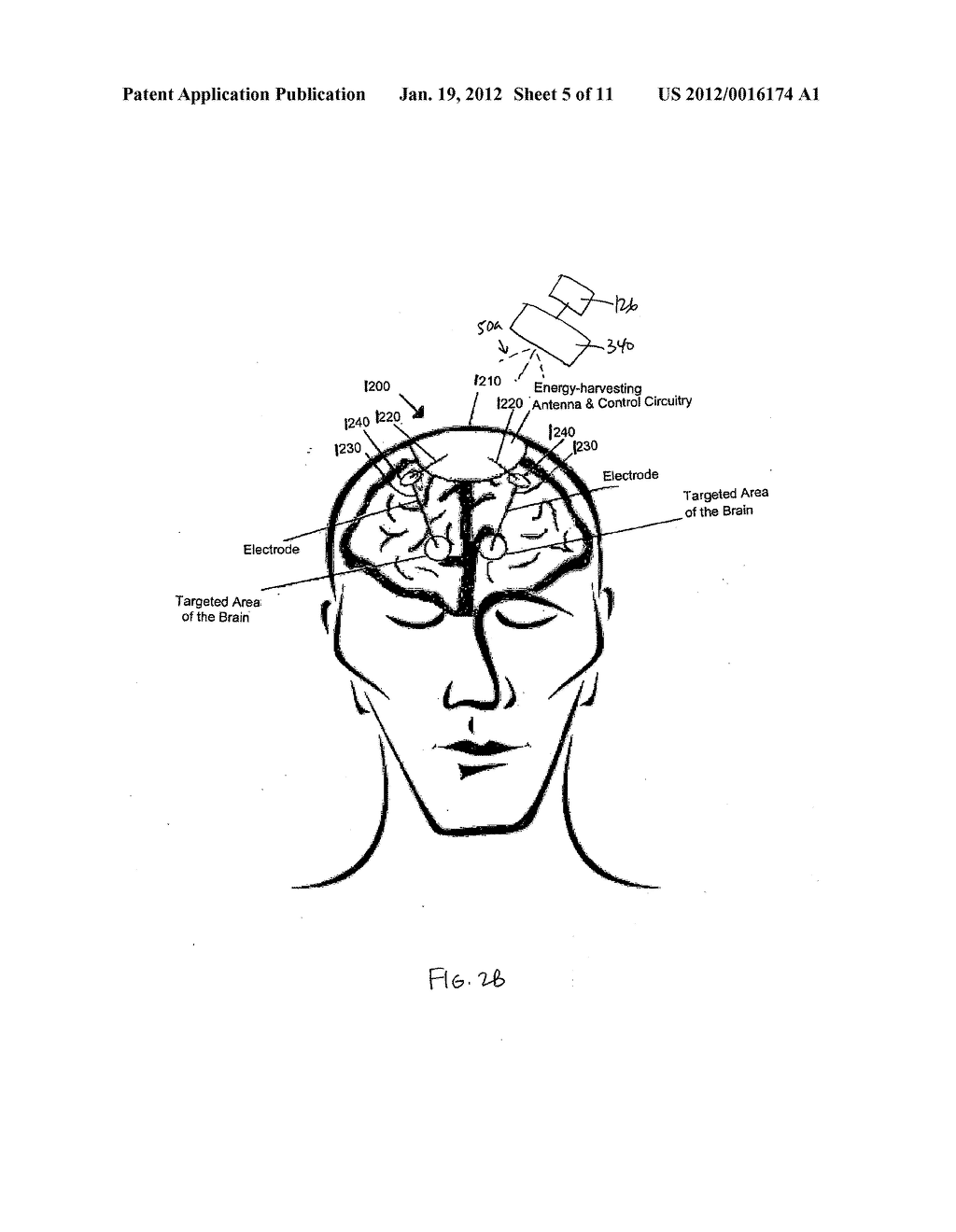 DEVICE AND METHOD FOR PROVIDING A SYNERGISTIC COMBINATION  OF PHOTOTHERAPY     AND A NON-LIGHT ENERGY MODALITY TO THE BRAIN - diagram, schematic, and image 06