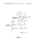 NON-INVASIVE DEVICE FOR SYNCHRONIZING CHEST COMPRESSION AND VENTILATION     PARAMETERS TO RESIDUAL MYOCARDIAL ACTIVITY DURING CARDIOPULMONARY     RESUSCITATION diagram and image