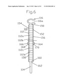 MIDDLE EAR IMPLANT diagram and image