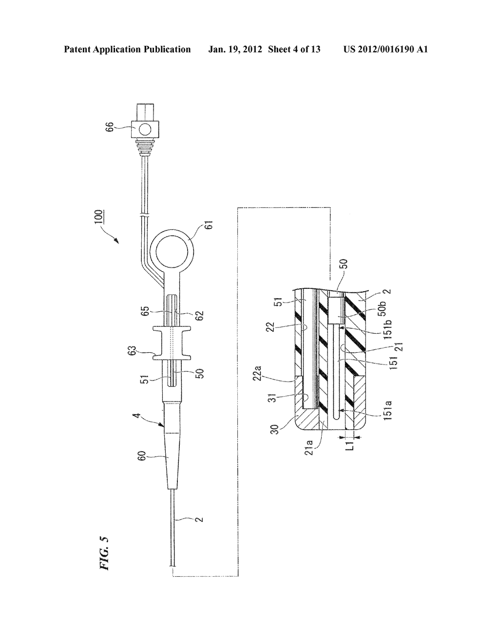 ENDOSCOPE TREATMENT INSTRUMENT - diagram, schematic, and image 05