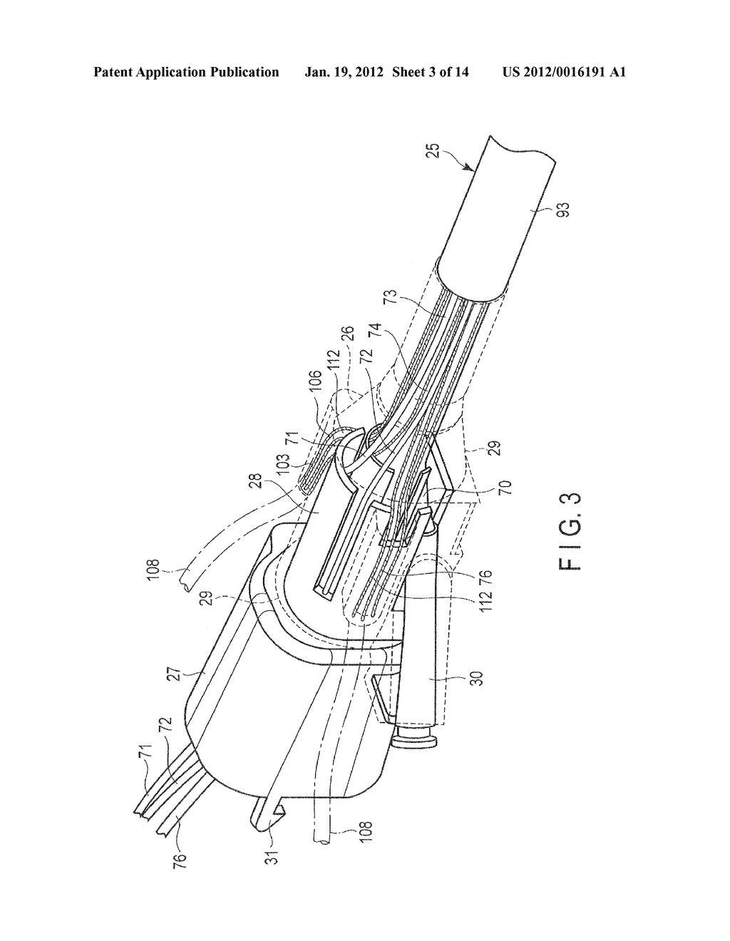 COVER-ADAPTED TREATMENT ENDOSCOPE AND ENDOSCOPE COVER - diagram, schematic, and image 04