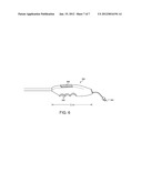 METHODS AND SYSTEMS FOR MINIMALLY INVASIVE ENDOSCOPIC SURGERIES - DEVICE diagram and image