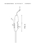 METHODS AND SYSTEMS FOR MINIMALLY INVASIVE ENDOSCOPIC SURGERIES diagram and image