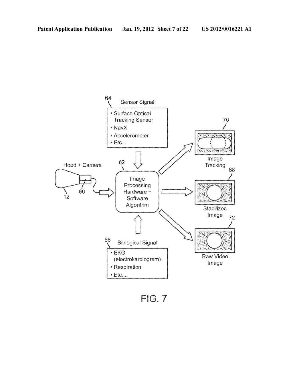 IMAGE STABILIZATION TECHNIQUES AND METHODS - diagram, schematic, and image 08