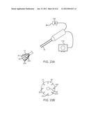 IMAGE STABILIZATION TECHNIQUES AND METHODS diagram and image