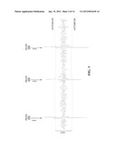 METHOD AND DEVICE FOR NOISE DETECTION IN PHYSIOLOGICAL SIGNALS diagram and image