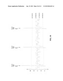 METHOD AND DEVICE FOR NOISE DETECTION IN PHYSIOLOGICAL SIGNALS diagram and image