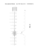 METHOD AND DEVICE FOR NOISE DETECTION IN PHYSIOLOGICAL SIGNALS diagram and image