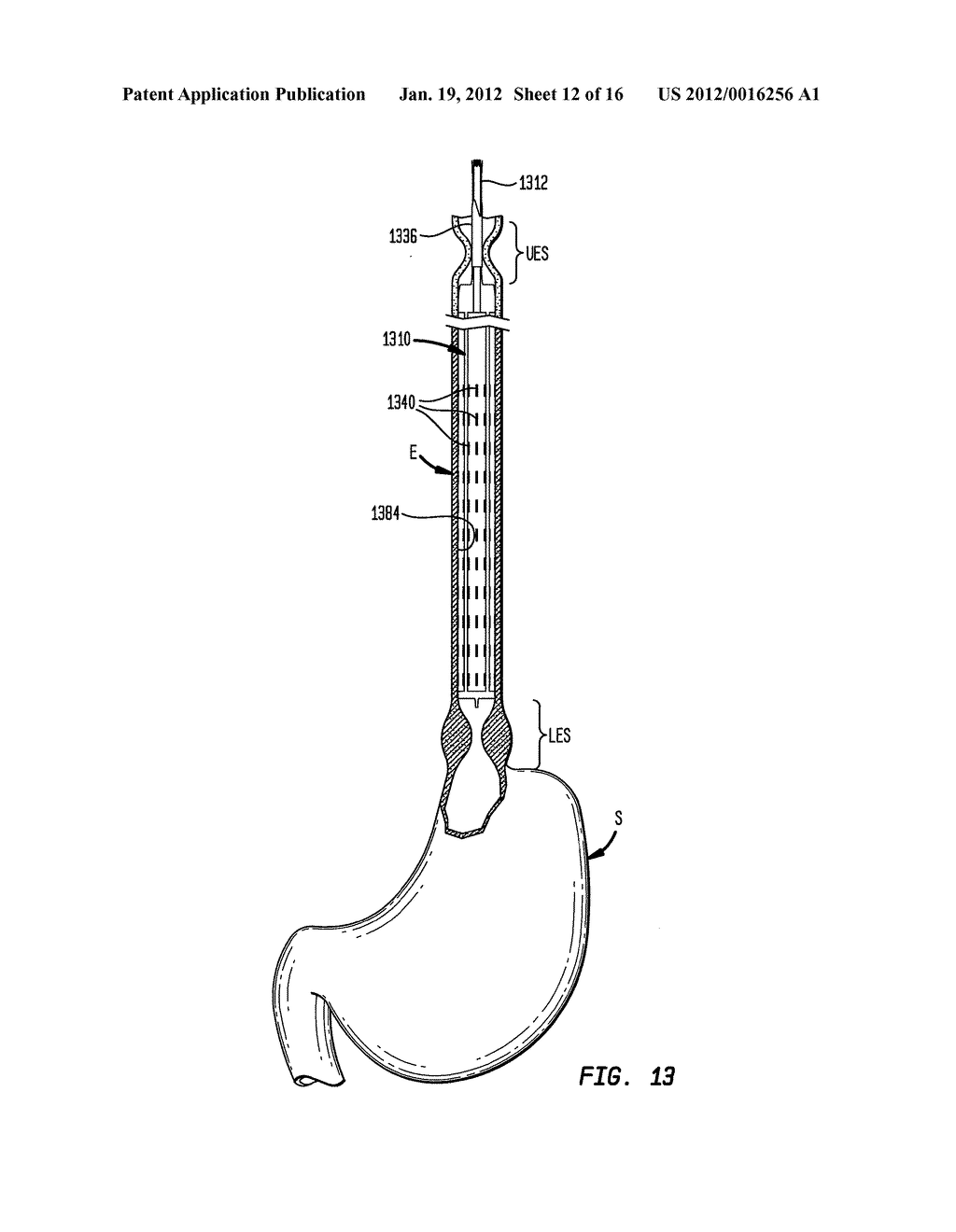 APPARATUS AND METHOD FOR DETECTING AND MEASURING CONDITION OF ESOPHAGEAL     MUCOSA AND INDICATIONS OF GASTROESOPHAGEAL REFLUX DISEASE - diagram, schematic, and image 13