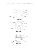 RETRACTOR CANNULA SYSTEM FOR ACCESSING AND VISUALIZING SPINE AND RELATED     METHODS diagram and image