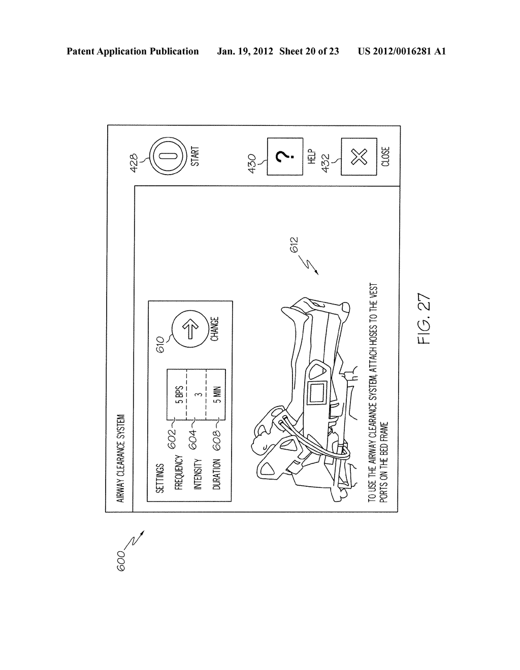 PULMONARY MATTRESS - diagram, schematic, and image 21