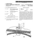 PEG TUBE WITH WIRELESS PULL TIP diagram and image