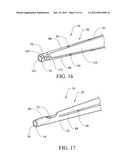 PEG TUBE WITH WIRELESS PULL TIP diagram and image